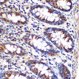 Anti-FGF2 antibody used in IHC (Paraffin sections) (IHC-P). GTX64354