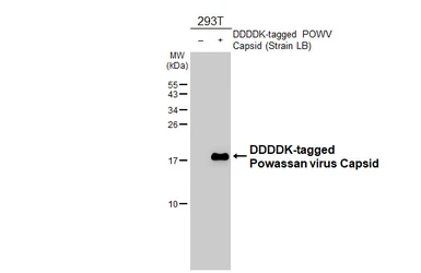 Anti-Powassan virus Capsid antibody [HL4301] used in Western Blot (WB). GTX643541