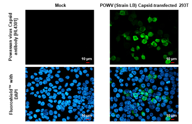 Anti-Powassan virus Capsid antibody [HL4301] used in Immunocytochemistry/ Immunofluorescence (ICC/IF). GTX643541