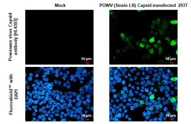 Anti-Powassan virus Capsid antibody [HL4303] used in Immunocytochemistry/ Immunofluorescence (ICC/IF). GTX643543