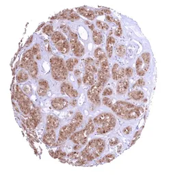 Anti-Galectin 3 antibody [HMV4336] HistoMAX&trade; used in IHC (Paraffin sections) (IHC-P). GTX643586