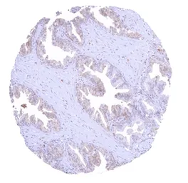 Anti-Galectin 3 antibody [HMV4336] HistoMAX&trade; used in IHC (Paraffin sections) (IHC-P). GTX643586
