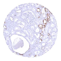 Anti-Galectin 3 antibody [HMV4336] HistoMAX&trade; used in IHC (Paraffin sections) (IHC-P). GTX643586