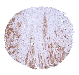 Anti-Galectin 3 antibody [HMV4336] HistoMAX&trade; used in IHC (Paraffin sections) (IHC-P). GTX643586
