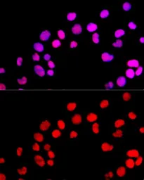 Anti-DNMT1 antibody used in Immunocytochemistry/ Immunofluorescence (ICC/IF). GTX64361