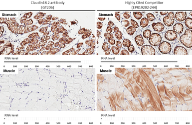 Anti-Claudin 18.2 antibody [GT206] used in IHC (Paraffin sections) (IHC-P). GTX643617