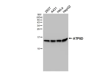 Anti-ATP5D antibody [HL4372] used in Western Blot (WB). GTX643629