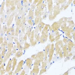 Anti-eIF2 alpha antibody used in IHC (Paraffin sections) (IHC-P). GTX64363