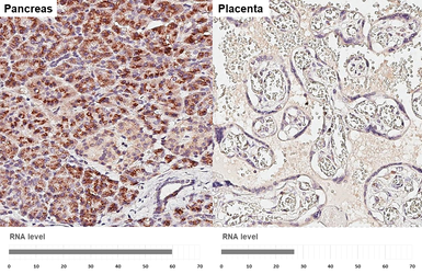 Anti-GALNT2 antibody [HL4377] used in IHC (Paraffin sections) (IHC-P). GTX643634