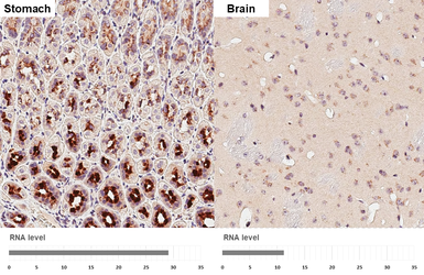 Anti-GALNT2 antibody [HL4377] used in IHC (Paraffin sections) (IHC-P). GTX643634