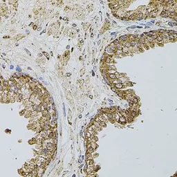 Anti-CD62P antibody used in IHC (Paraffin sections) (IHC-P). GTX64365
