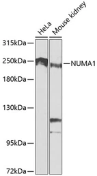 Anti-NuMA antibody used in Western Blot (WB). GTX64368