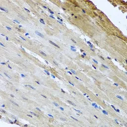 Anti-NuMA antibody used in IHC (Paraffin sections) (IHC-P). GTX64368