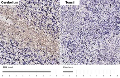 Anti-S1PR5 / EDG8 antibody [HL4441] used in IHC (Paraffin sections) (IHC-P). GTX643730