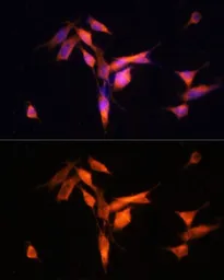 Anti-MMP10 antibody used in Immunocytochemistry/ Immunofluorescence (ICC/IF). GTX64385