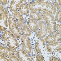 Anti-MMP10 antibody used in IHC (Paraffin sections) (IHC-P). GTX64385