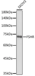 Anti-FSH Receptor antibody used in Western Blot (WB). GTX64391