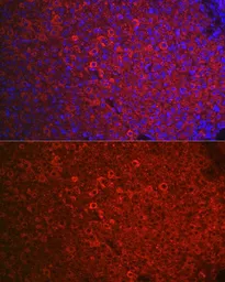 Anti-FSH Receptor antibody used in IHC (Paraffin sections) (IHC-P). GTX64391