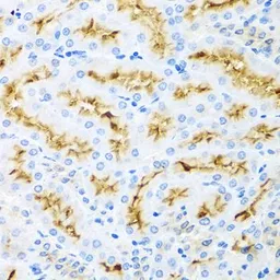 Anti-MDC antibody used in IHC (Paraffin sections) (IHC-P). GTX64394