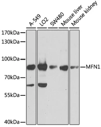 Anti-MFN1 antibody used in Western Blot (WB). GTX64398