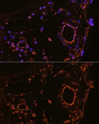 Anti-YB1 antibody used in IHC (Paraffin sections) (IHC-P). GTX64401