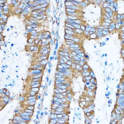Anti-YB1 antibody used in IHC (Paraffin sections) (IHC-P). GTX64401