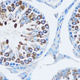 Anti-YB1 antibody used in IHC (Paraffin sections) (IHC-P). GTX64401