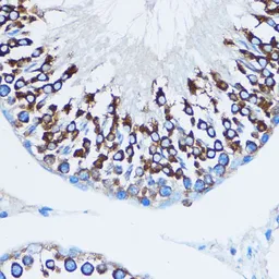 Anti-YB1 antibody used in IHC (Paraffin sections) (IHC-P). GTX64401