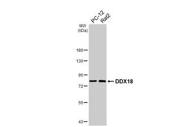 Anti-DDX18 antibody [HL4449] used in Western Blot (WB). GTX644014