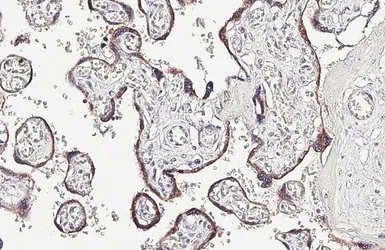 Anti-VDAC2 antibody [HL4477] used in IHC (Paraffin sections) (IHC-P). GTX644044