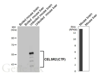 Anti-CELSR2 antibody [HL4484] used in Western Blot (WB). GTX644051