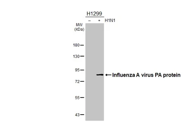 Anti-Influenza A virus PA protein antibody [HL4504] used in Western Blot (WB). GTX644074