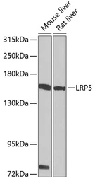 Anti-LRP5 antibody used in Western Blot (WB). GTX64412