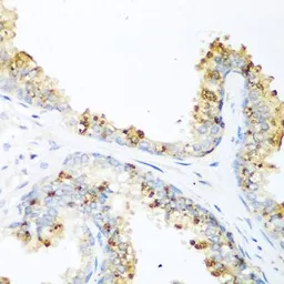 Anti-LRP5 antibody used in IHC (Paraffin sections) (IHC-P). GTX64412
