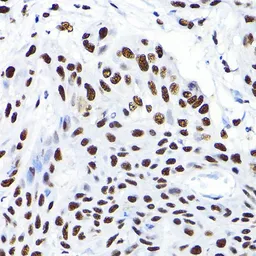 Anti-KAP1 antibody used in Immunocytochemistry/ Immunofluorescence (ICC/IF). GTX64422