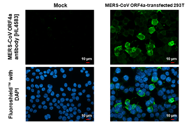 Anti-MERS-CoV ORF4a antibody [HL4583] used in Immunocytochemistry/ Immunofluorescence (ICC/IF). GTX644259