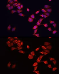 Anti-BNIP3 antibody used in Immunocytochemistry/ Immunofluorescence (ICC/IF). GTX64429