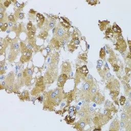 Anti-BNIP3 antibody used in IHC (Paraffin sections) (IHC-P). GTX64429