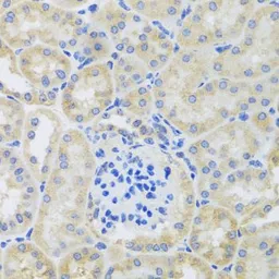 Anti-BNIP3 antibody used in IHC (Paraffin sections) (IHC-P). GTX64429