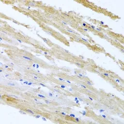 Anti-BNIP3 antibody used in IHC (Paraffin sections) (IHC-P). GTX64429