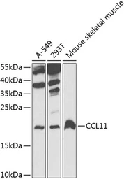 Anti-Eotaxin antibody used in Western Blot (WB). GTX64437