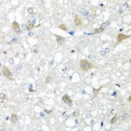 Anti-Eotaxin antibody used in IHC (Paraffin sections) (IHC-P). GTX64437