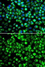 Anti-Renin Receptor antibody used in Immunocytochemistry/ Immunofluorescence (ICC/IF). GTX64438
