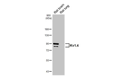 Anti-Kv1.4 antibody [GT240] used in Western Blot (WB). GTX644459