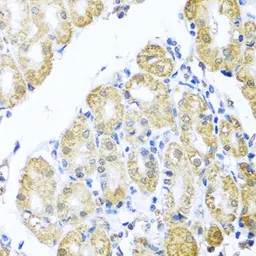 Anti-BNIP3L antibody used in IHC (Paraffin sections) (IHC-P). GTX64447