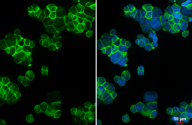 Anti-CCR4 antibody [HL4612] used in Immunocytochemistry/ Immunofluorescence (ICC/IF). GTX644476