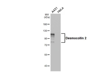 Anti-Desmocollin 2 antibody [HL4634] used in Western Blot (WB). GTX644507