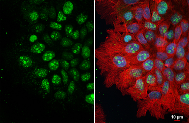 Anti-Ki67 antibody [GT258] used in Immunocytochemistry/ Immunofluorescence (ICC/IF). GTX644548