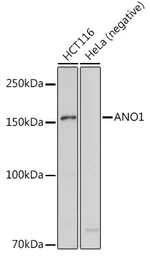 Anti-TMEM16A antibody used in Western Blot (WB). GTX64457