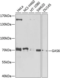 Anti-GAS6 antibody used in Western Blot (WB). GTX64470